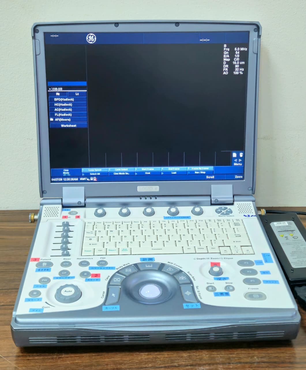 Portable Ultrasound Machine – GE Logiq e (with Convex & Linear Probes)
